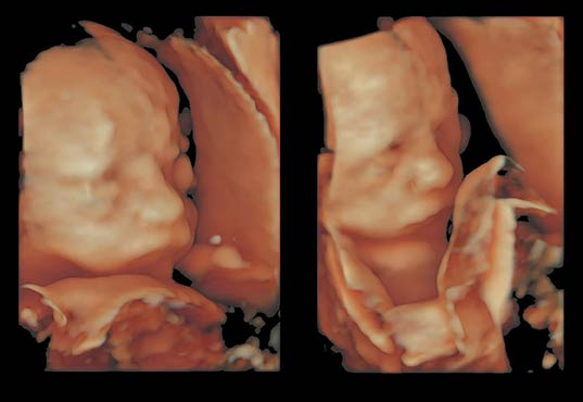 ultrasound near me